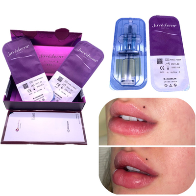 ইনজেকশন Ha Filler Juvederm 2x1ml Lip Enhancement রিঙ্কেল দূর করে