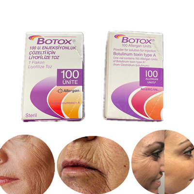 ইংরেজি সংস্করণ টাইপ A Botulinum Toxin 100 Iu Allergan  for Wrinkles