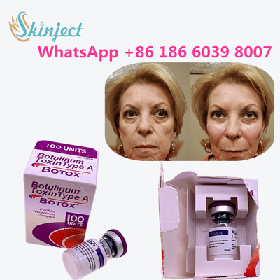 বলিরেখা দূর করার জন্য 100% আসল বোটুলিনাম টক্সিন বোটক্স 100u