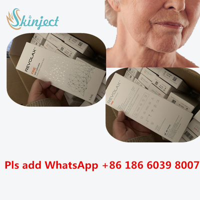 হায়ালুরোনিক অ্যাসিড পেন ফিলার KOEAR Revolax Hyaluronic অ্যাসিড ডার্মাল ফেসিয়াল প্লাস্টিক