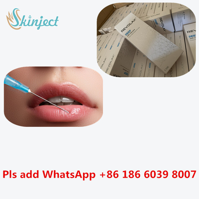 ইনজেকশনযোগ্য ডার্মাল ফিলার রেভোলাক্স 24 Mg/Ml HA হায়ালুরোনিক অ্যাসিড ইনজেকশন