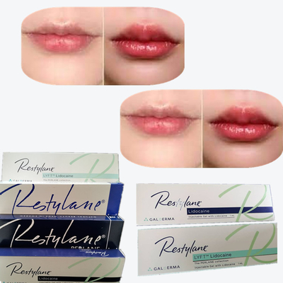 2*1 মিলি/বক্স ক্রস লিঙ্কড ডার্মাল ফিলার