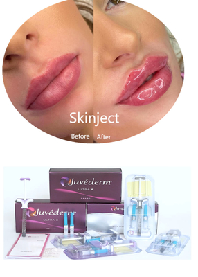 Juvederm Hyaluronic Acid Facial Dermal Filler Injectable 2*1ml প্যাকিং