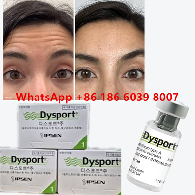 Botulinum Toxin Dysport 100u Clostridium Botulinum Type A For Facial Anti-aging Wrinkle (মুখের পক্বতা প্রতিরোধের জন্য বোটুলিনাম টক্সিন ডিসপোর্ট ১০০ ইউ)
