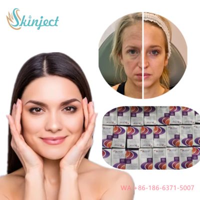 Allergan Botox Nobota 100u 200u for Effective Treatment of Frown Lines Botulinum Toxin Injections