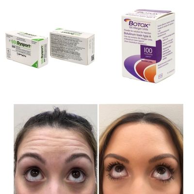 100 ইউনিট কোরিয়া বিটিএক্স বোটুলিনাম টক্সিন ফ্রিজ এবং সূক্ষ্ম লাইন জন্য