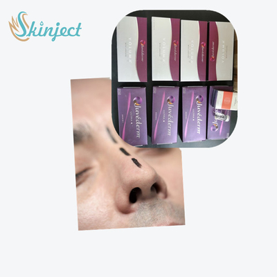 ঠোঁটের জন্য হায়ালুরোনিক অ্যাসিড ডার্মাল ফিলার জুভেডার্ম আল্ট্রা3