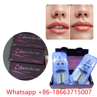 জুভেডার্ম আল্ট্রা 4 (2x1ml) ইনজেকশনযোগ্য ডার্মাল ফিলার ঠোঁট বড় করা