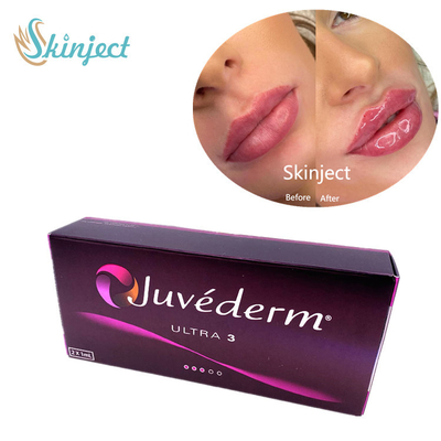 Juvederm Ultra3 2x1ml হায়ালুরোনিক অ্যাসিড ফেসিয়াল ফিলার ডার্মাল