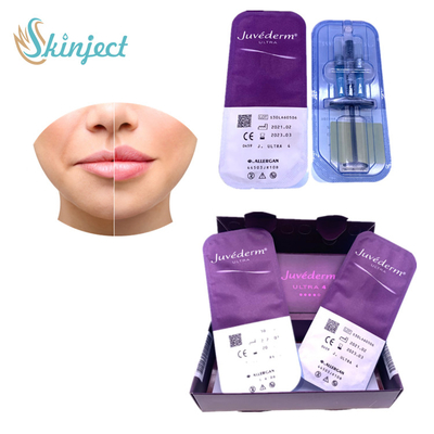 Juvederm Ultra4 ঠোঁট বৃদ্ধি ডার্মাল ফিলার Hyaluronic অ্যাসিড