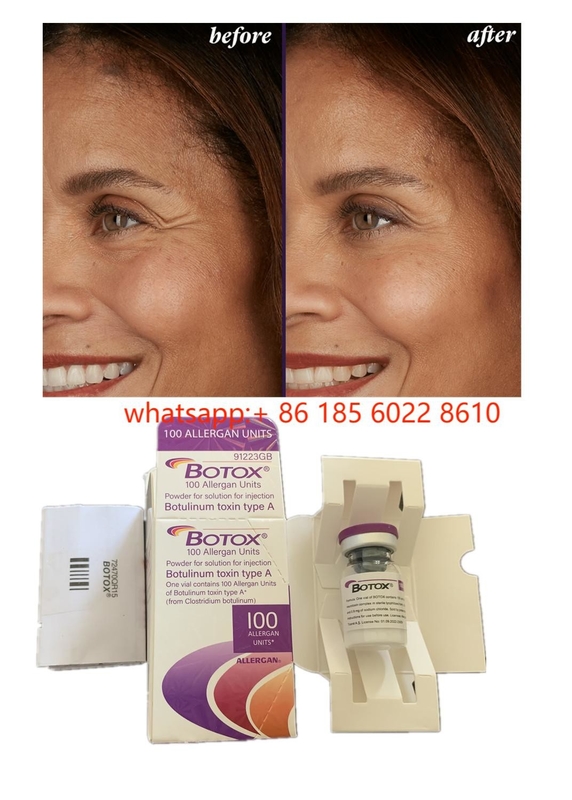 সৌন্দর্য পণ্য Allergan 100units Botulinum Toxin মুখের wrinkles জন্য বোটক্স ত্বকের ফিলার