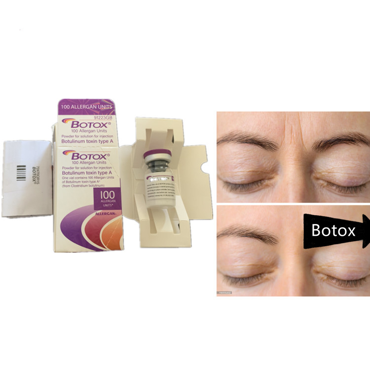 Allergan 100ui বোটুলিনাম টক্সিন সিরাম মুখের ডিসপোর্ট জন্য অ্যান্টি-এজিং পণ্য