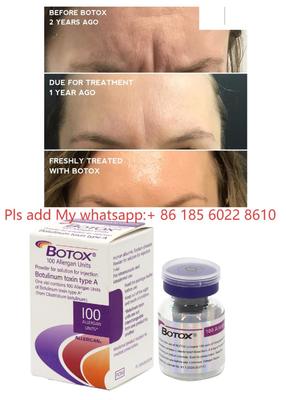 Allergan Botox 100IU Dysport ইনজেকশন বোটুল্যাক্স বোটুলিনাম টক্সিন, বলিরেখা দূর করে